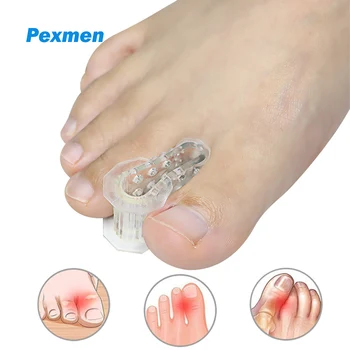 Pexmen 2 елемента Разделител за пръстите на краката, коректор на палеца на крака, подплата за защита на пръстите на краката, разпределителя за мъже и жени, выпрямляющий перекрывающиеся и извивките на пръстите на краката